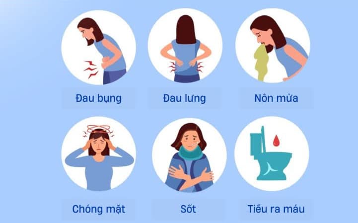 Khi bị sỏi đường tiết niệu thì có dấu hiệu gì